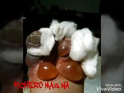 The guy took a bad step