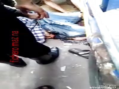 Man rescued with mutilated legs