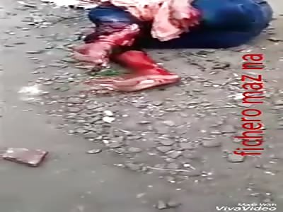 Man loses foot in accident