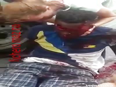 Black with disfigured face