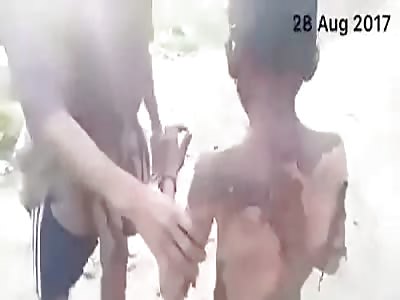 Black stopped stealing a week and is turning white