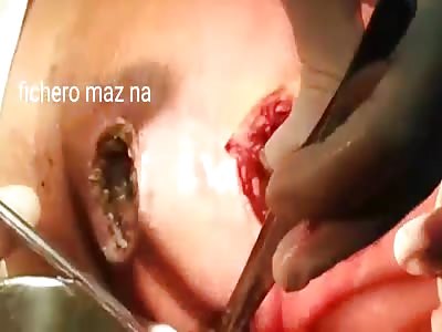 Ass rotten for consuming crocodile drugs