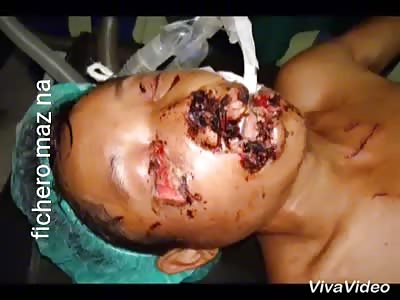 Wife gives passionate kiss to her husband with everything and bite