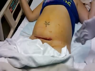 Beautiful wound very sexy