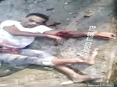 Broken man in accident