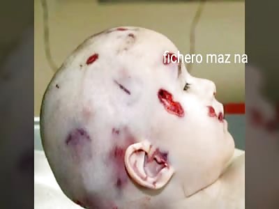 They killed him for hiding the remote