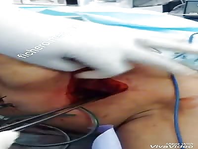 Woman has very arousing vagina on the chest