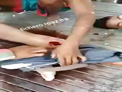 MEN DEAD AND INJURED: dead men and a man with broken foot because of accident