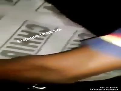 ACCIDENT: loss of limbs in accident