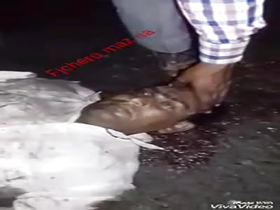 ACCIDENT: man is split in two when suffering an accident