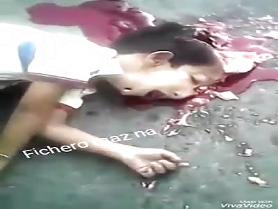 BRUTAL: boy is run over by motorcyclist and remains with shattered head