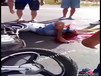 ACCIDENT :man loses his leg