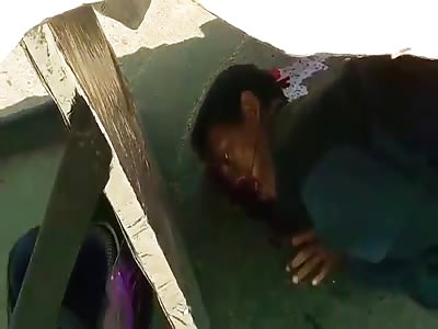 ACCIDENT: casual covering the sun to the dead so it does not stink