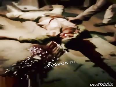 ACCIDENT: man falls and hits his head