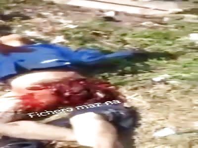 Elderly man with ripped leg in horrific accident (still alive)