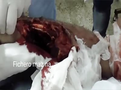 His arm is seriously fucked.