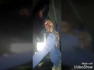 ACCIDENT: men die when suffering a serious accident