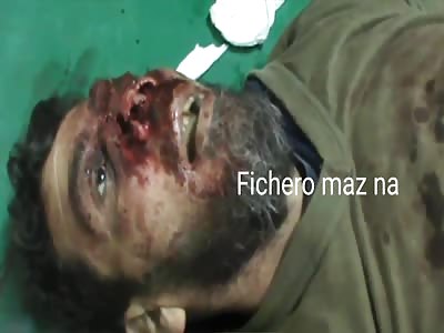 man totally disfigured