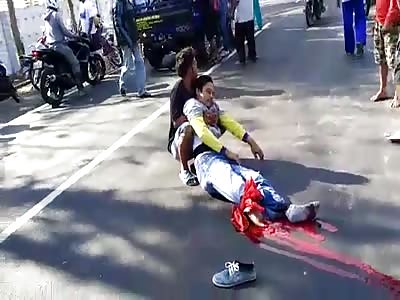 MAN LOSES FOOT IN ACCIDENT