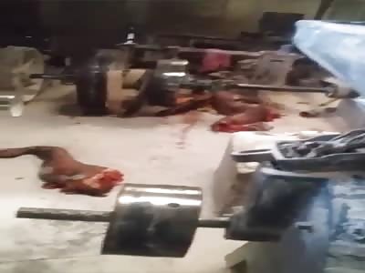 man dismembered in a work accident