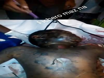 MAN WITH TERRIBLE STRIKES IN HIS BODY