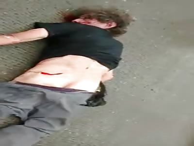 MAN SUFFER TERRIBLE ACCIDENT