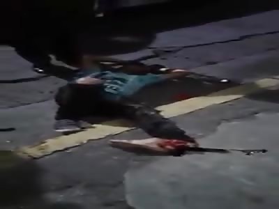 MOTORCYCLE SUFFER ACCIDENT AND FOOT WASTE