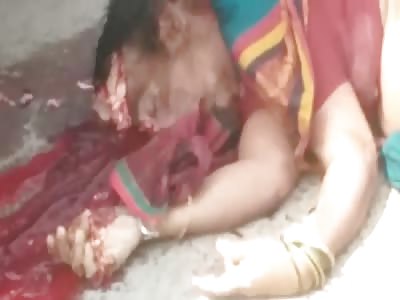 WOMAN WITH THE DESTROYED HEAD