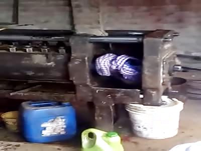 WORK ACCIDENT MAN LOSES ARM