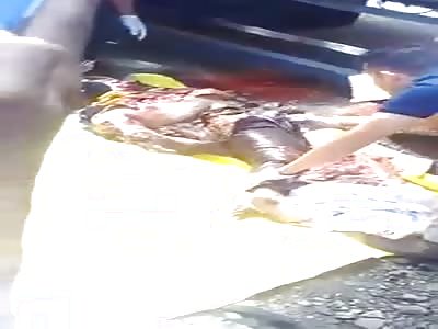 Boy Run over by Something Heavy is Nothing but Guts Now .