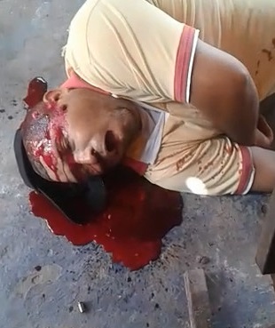 Dude Shot in the Head Takes his Last Dramatic Last Breathe of Air 