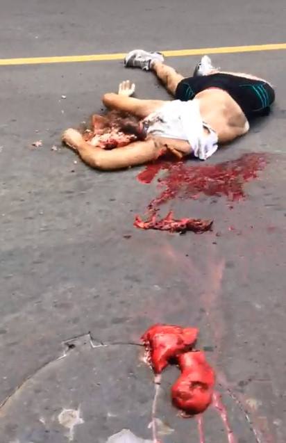 Poor Lady Crushed to Death is Nothing but Guts Now