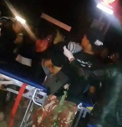 Boy head blown wide Open after crushed by truck