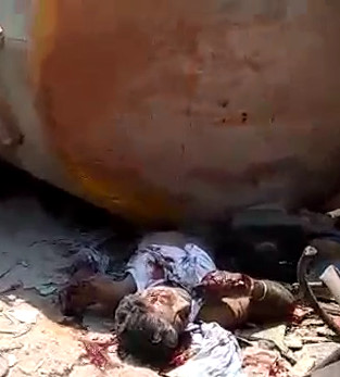 MAN CRUSHED BY TRUCK(still alive)