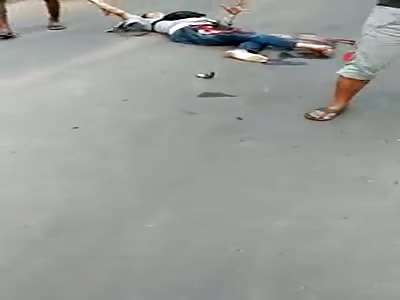 MAN SUFFERS FROM SERIOUS WOUND IN LEGS AFTER BEING EMBEDDED BY A TRUCK