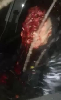 SKIN MASKS: Man's Head Ripped off after Horrific Accident . 