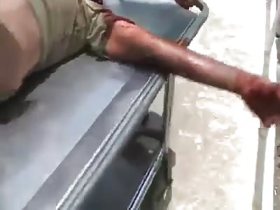 MAN WITH TREMENDAS INJURED BY MACHETE