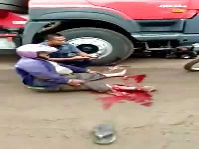 MAN OBESE WITH WOUND STANDING