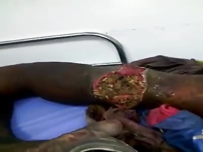 WTF !! ðŸ¤¢ðŸ¤¢ðŸ¤¢ðŸ¤¢