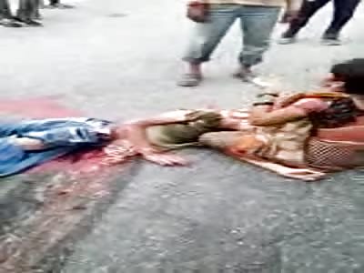 TERRIBLE ACCIDENT LETS WOMEN WITH EXPOSED INTESTINES