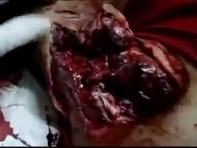 MAN WITH TREMENDO CUT IN THE NECK