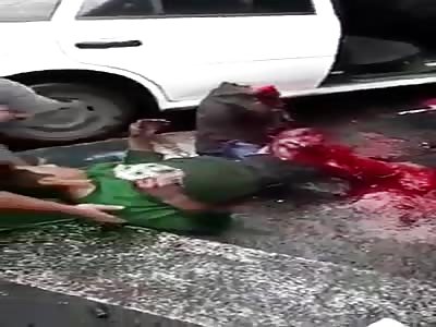 Dazed Man with Open Fracture of Leg Filmed Lying on Sidewalk