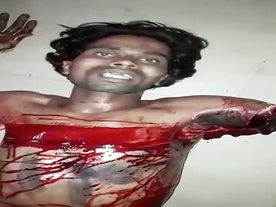 MAN LOSES THE ARM BY TRYING TO STEAL A MOTORCYCLE