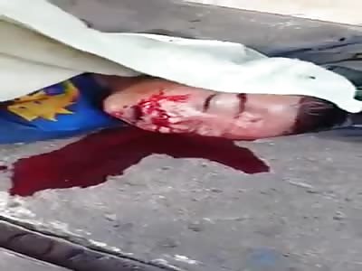 ACCIDENT OF MOTORCYCLIST