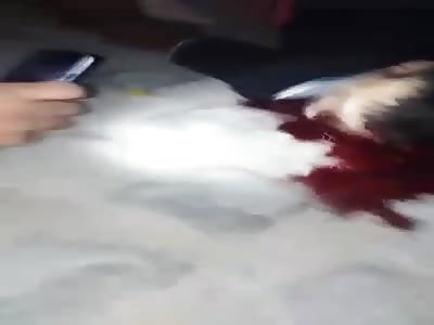 DEAD BY SHOT ON THE HEAD