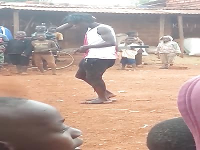 MAN WITH MACHETE IN STOMACH