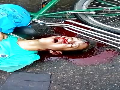 Dude Shot in the Brain... Takes his Last Dramatic Last Breathe of Air