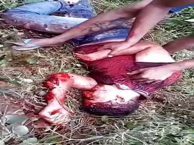 Let him Die...Man Mutilated from a Machete Dying 