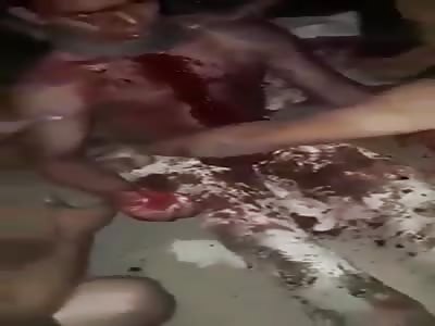 WOUND WITH KNIFE IN NECK