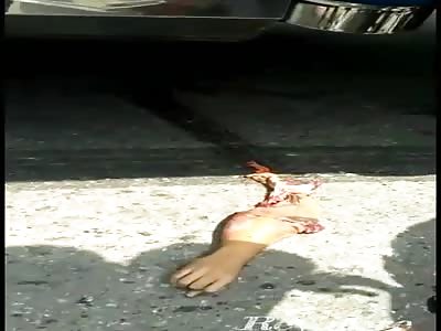 Hey Buddy , Here is Your Arm